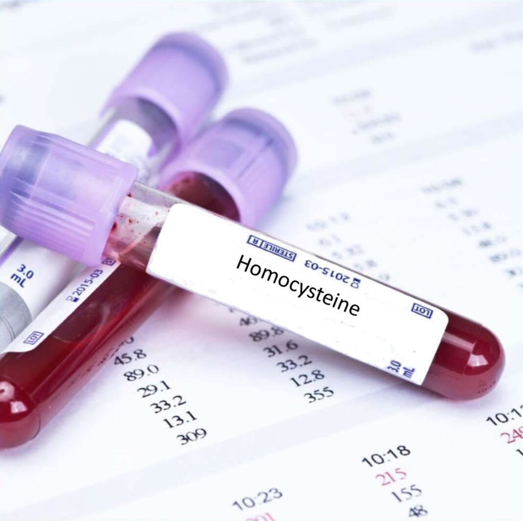 What Is Homocysteine? What Is Its Function?